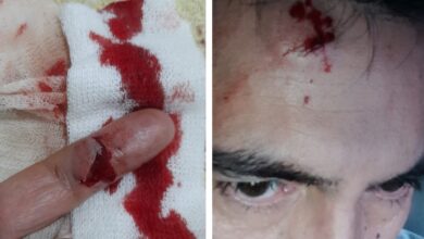 Photo of Ataque brutal al locutor de Radio Universal, Daniel Laurín
