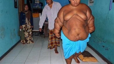 Photo of Así está ahora el nene “más gordo del mundo”